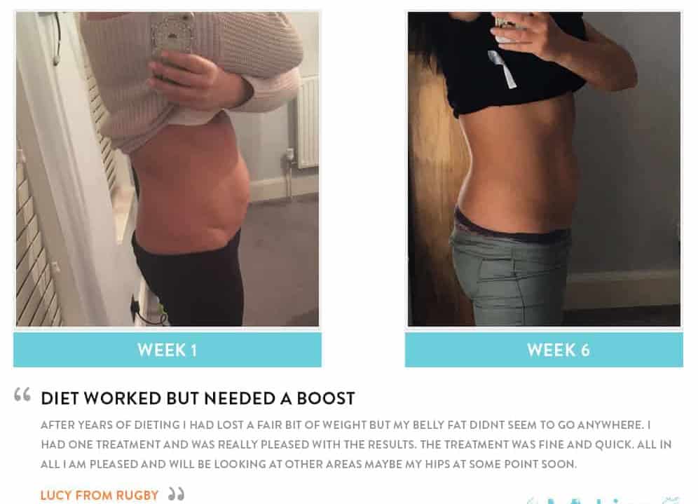 Before and After Dieting Upper Edmonton