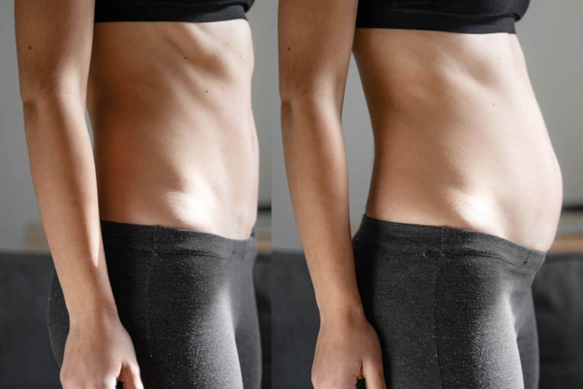 How long does diastasis recti take to improve Upper Edmonton?
