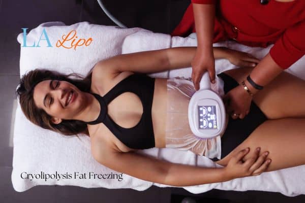 woman getting cryolipolysis Upper Edmonton