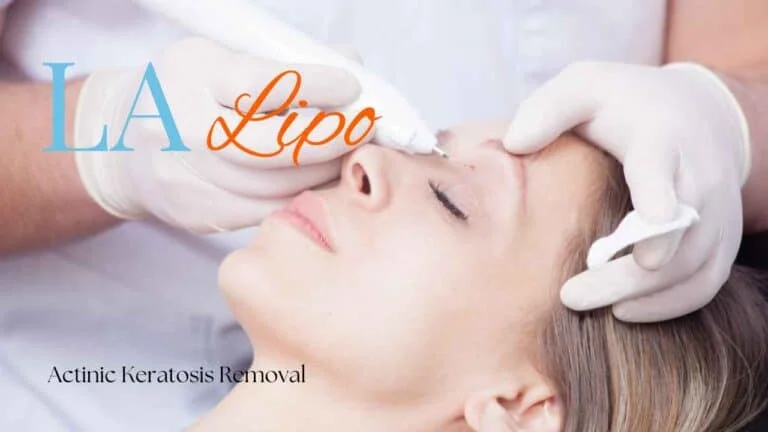 Woman receiving Actinic Keratosis Removal Treatment Upper Edmonton