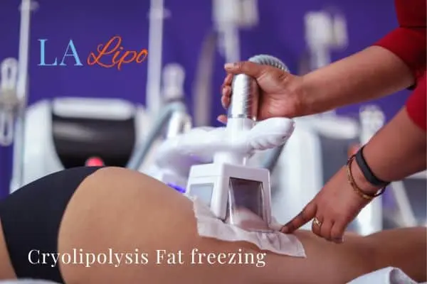women getting fat freezing Upper Edmonton