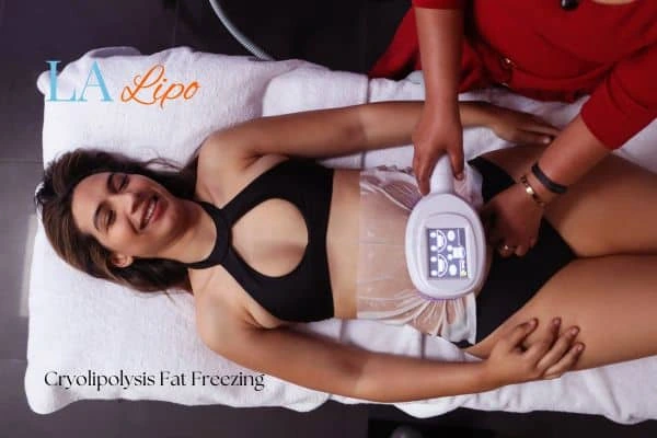 woman getting cryolipolysis Upper Edmonton