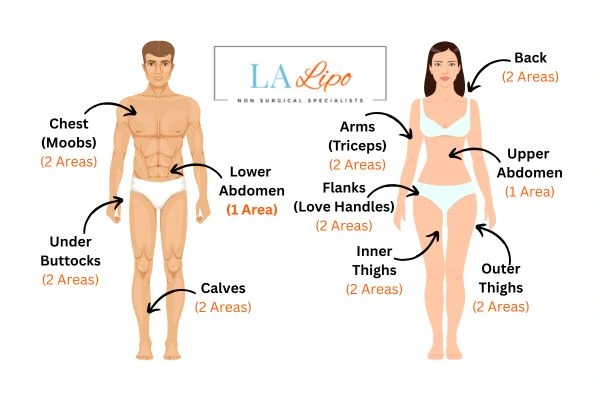 LA LIPO Cryolipolysis Areas Upper Edmonton
