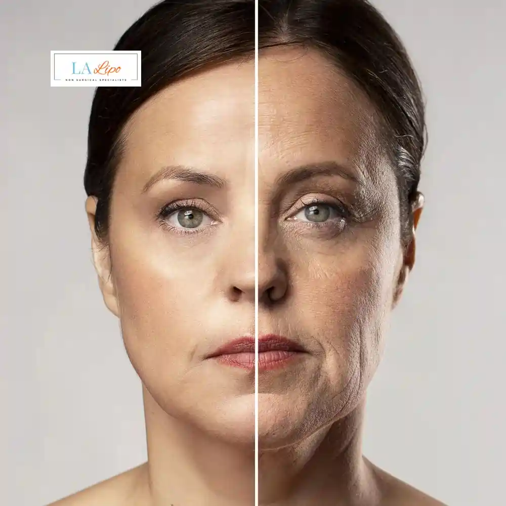 How Can You Tell If Non-Surgical Skin Tightening Is Right for You Upper Edmonton?