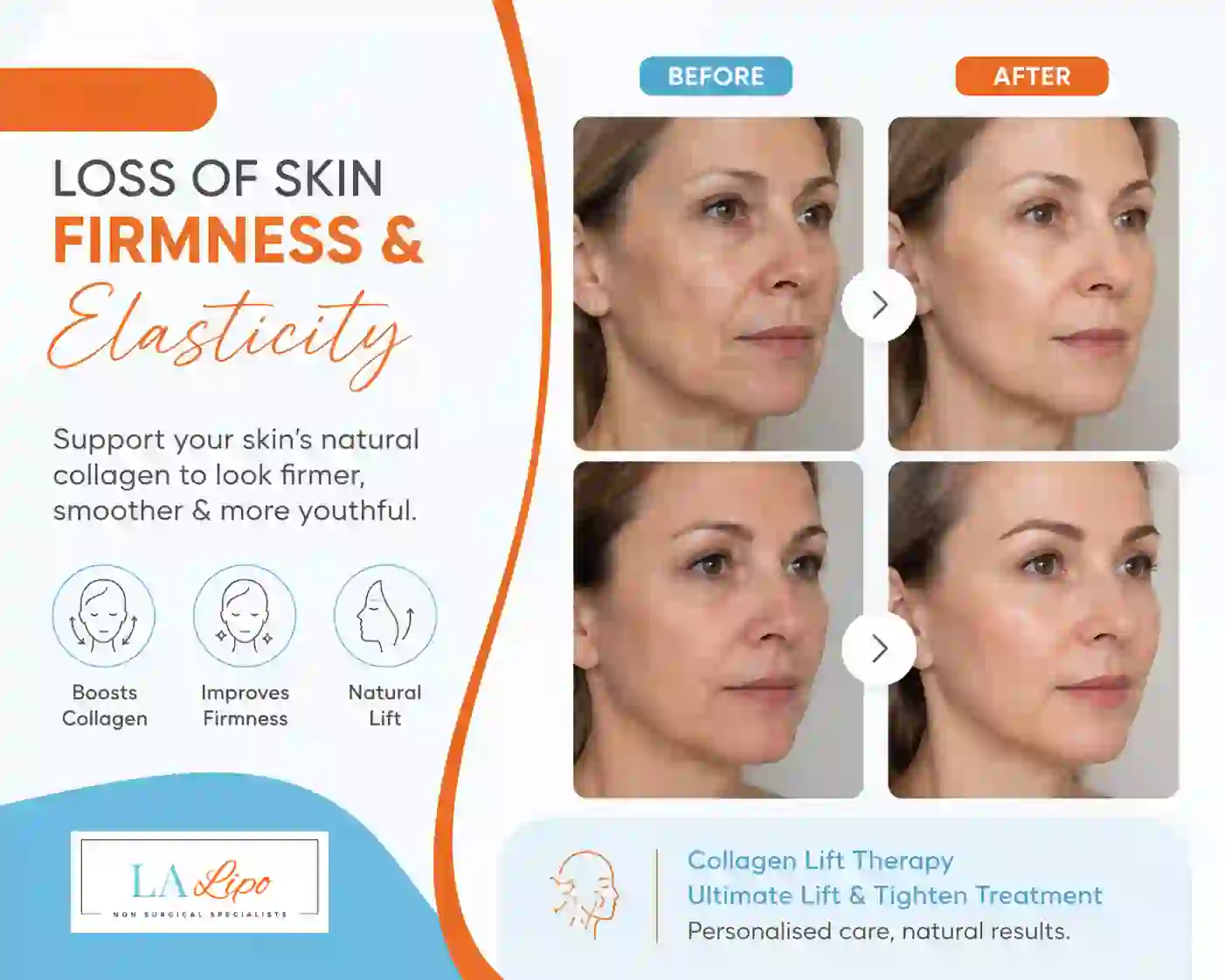 Sign #7: Loss of Skin Firmness and Elasticity Upper Edmonton